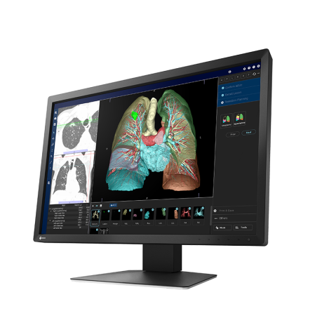 Monitory diagnostyczne do tomografii komputerowej i MRI