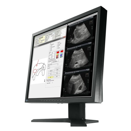 Monitor medyczny Eizo RadiForce MX194
