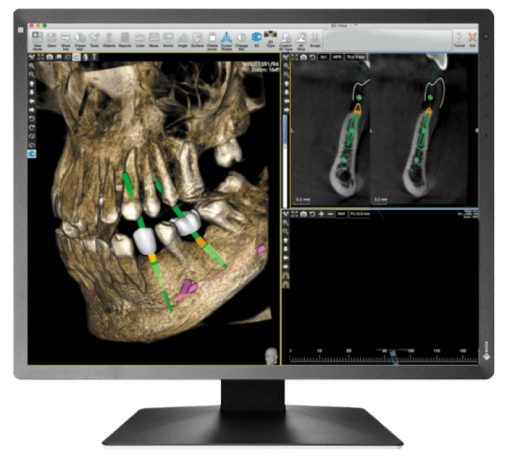 Monitor stomatologiczny Eizo Radiforce MX216HB