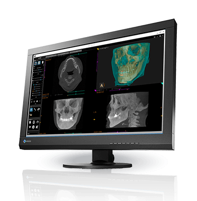 Analiza zdjęć na monitorze stomatologicznym Eizo Radiforce MX242W