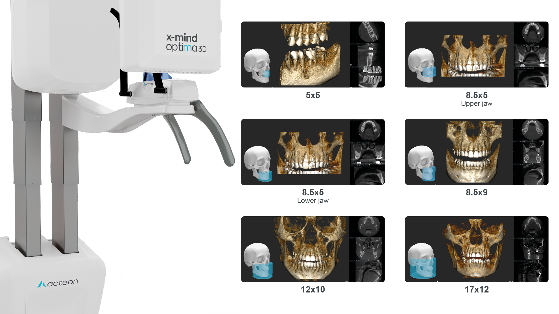 Tomograf CBCT Acteon X-Mind Trium TLD Pan Ceph 3D