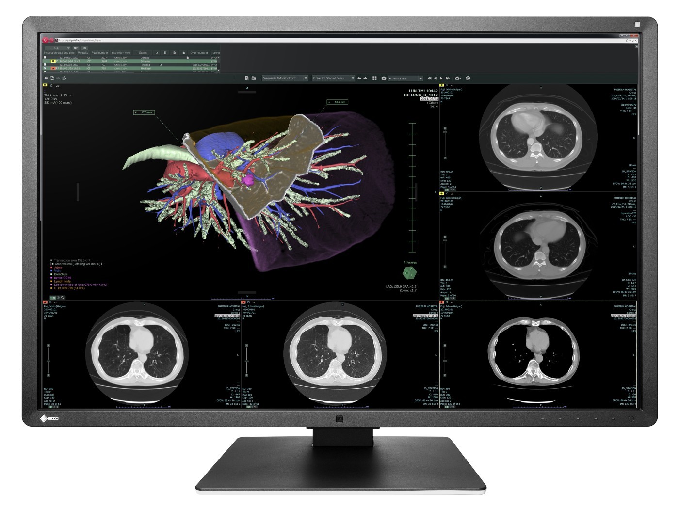 Monitor diagnostyczny RTG Eizo RadiForce RX660 - przód