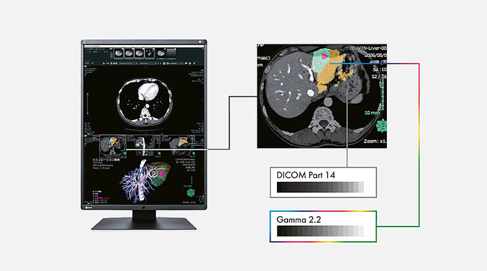 Kalibracja DICOM monitora medycznego Eizo RadiForce RX660