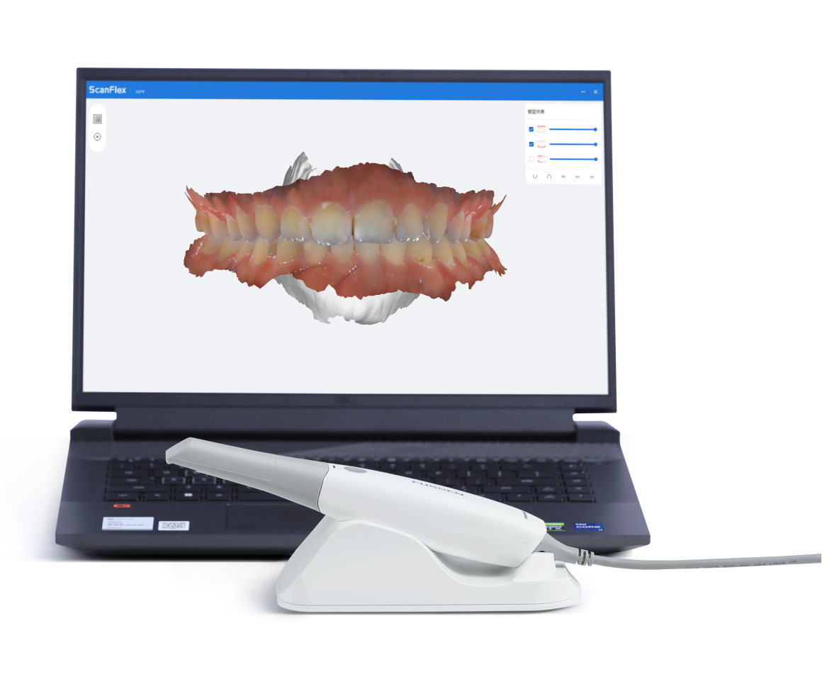 Zdjęcie uzyskane za pomocą skanera wewnątrzustnego Fussen S6500
