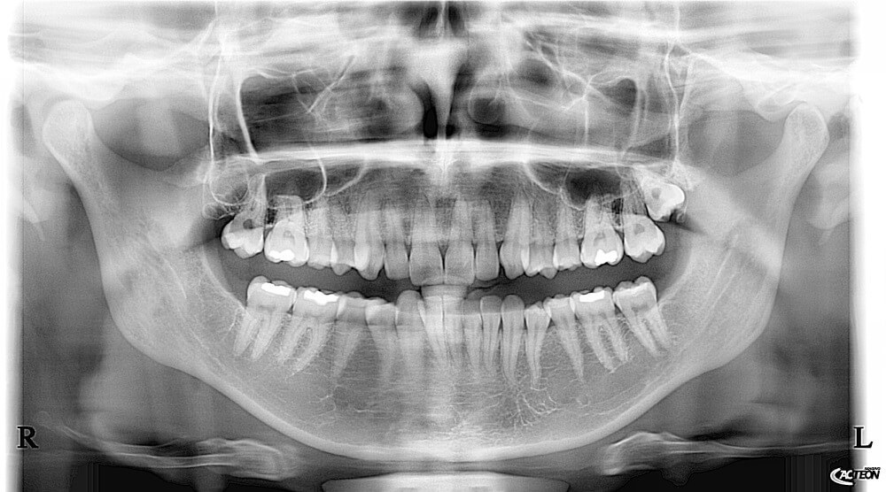 Tomograf CBCT - obrazowanie