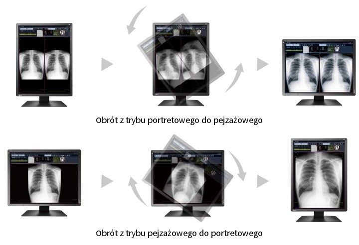 Monitory diagnostyczne do tomografii komputerowej - komfortowa obsługa