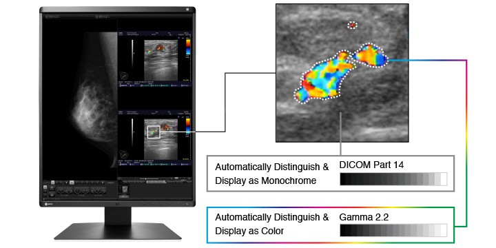 Monitory medyczne do mammografii - wielofunkcyjne i skuteczne
