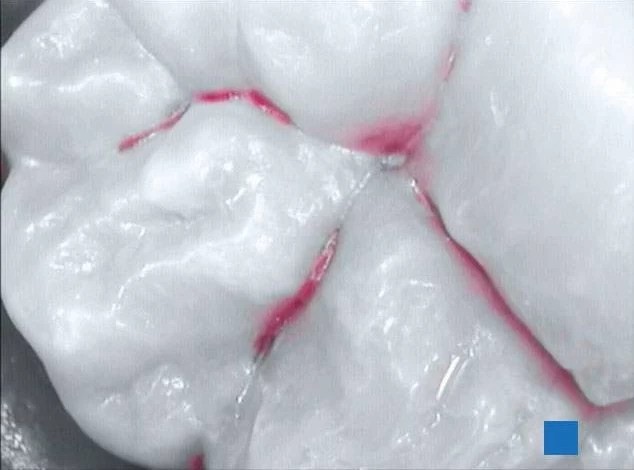 Tryb pracy kamery Acteon Sopro Care