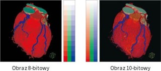 Eizo RadiForce MX194