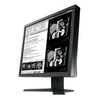Eizo RadiForce MX194