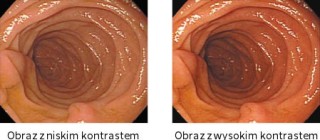 Eizo RadiForce MX194
