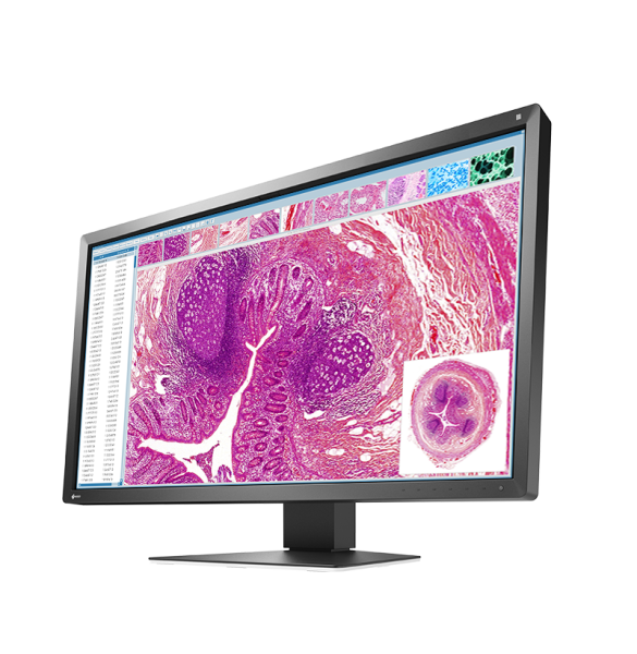 Eizo RadiForce MX317W