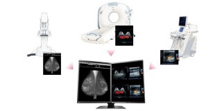 EIZO RadiForce RX560