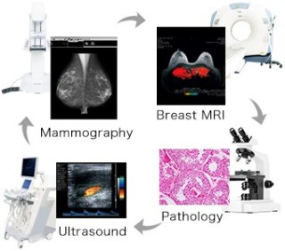 EIZO RadiForce RX560