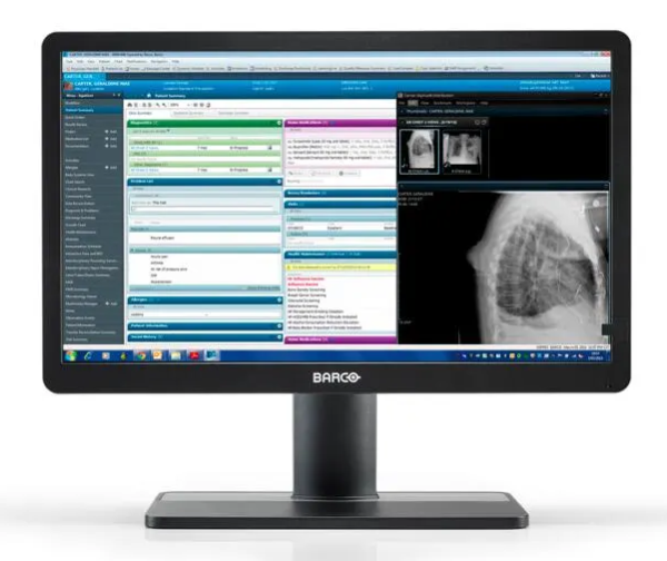 Monitor medyczny Barco Eonis 22" MDRC-2422