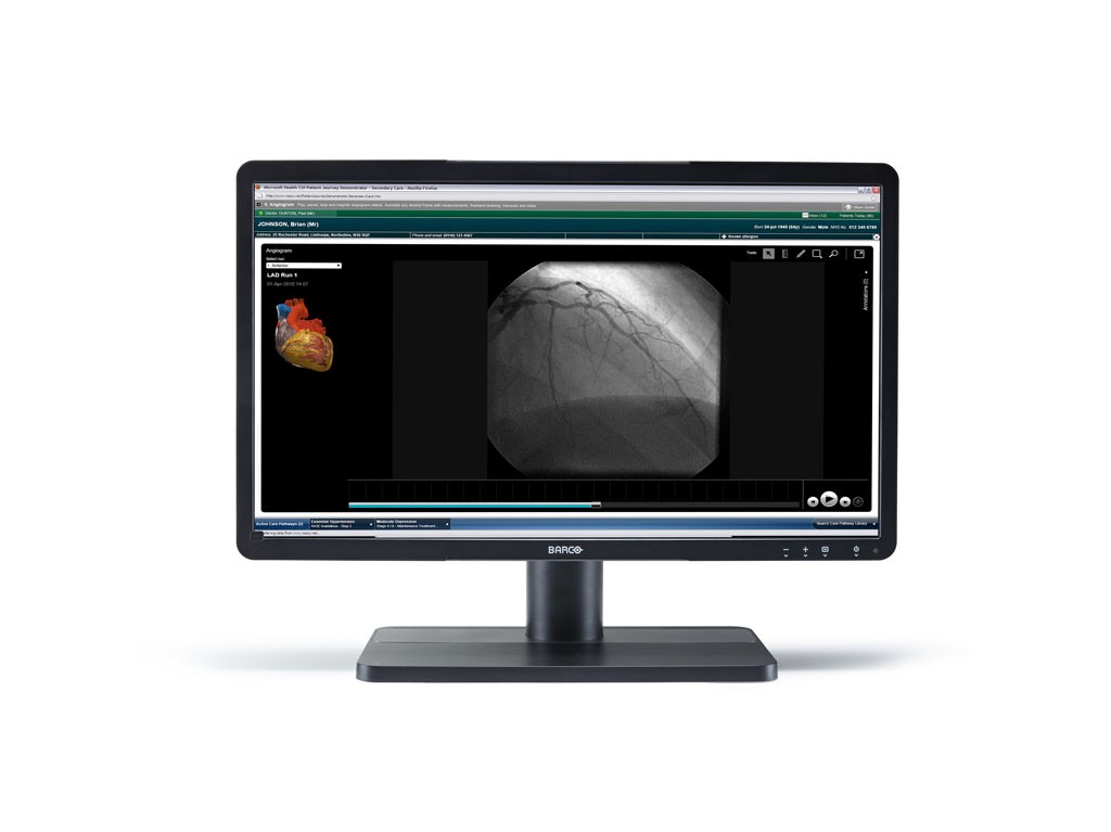 Monitor stomatologiczny Barco Eonis 22