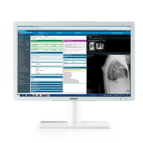 Barco Eonis 24” MDRC-2424 HNEW 16:10 – biały