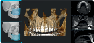 Acteon X-Mind Optima CORE 3D PANO