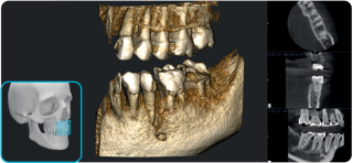 Acteon X-Mind Optima CORE 3D PANO
