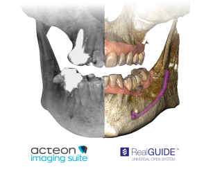 Acteon X-Mind Optima CORE 3D Pano Ceph
