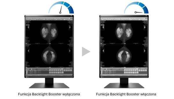 EIZO Radiforce GX570 - backlight booster