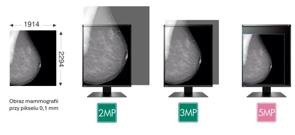 EIZO Radiforce GX570 - panel LTPS