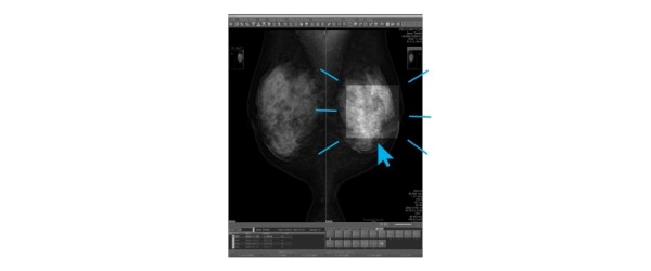 EIZO Radiforce GX570 - Point-and-Focus
