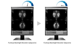 EIZO RadiForce GX570