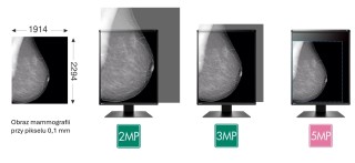 EIZO RadiForce GX570