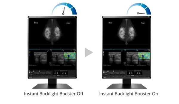 EIZO Radiforce RX570 - backlight booster