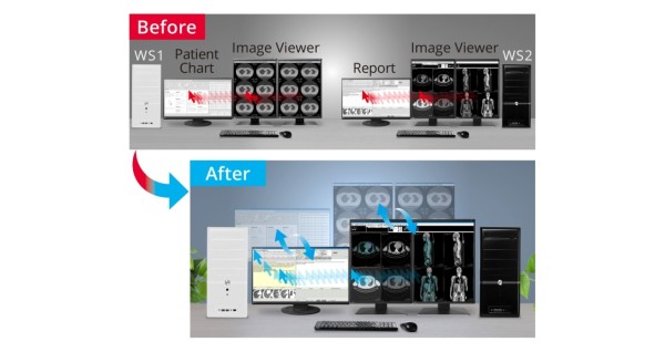 EIZO Radiforce RX570 - Switch-and-Go