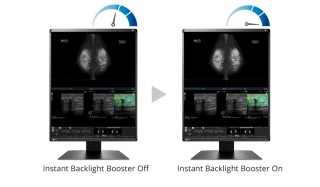 EIZO RadiForce RX570