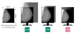 EIZO RadiForce RX570