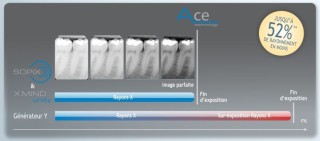 Czujnik Sopix - technologia Ace