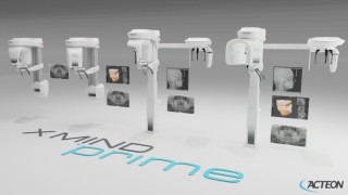 Acteon X-Mind Prime Pan - dostępne wersje