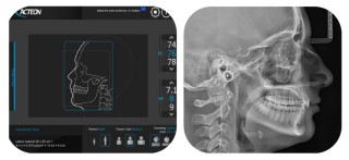 Zdjęcia wykonane aparatem Acteon X-Mind Prime Pan Ceph