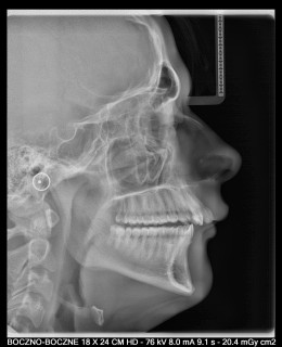 Acteon X-Mind Prime z cefalo