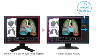 Eizo RadiForce MX243W  - porównanie panoramicznego obrazu