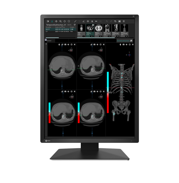 Eizo RadiForce MX217