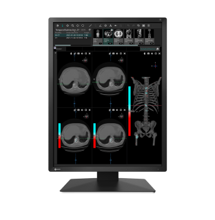 Eizo RadiForce MX217
