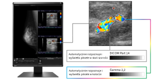 Eizo RadiForce MX217